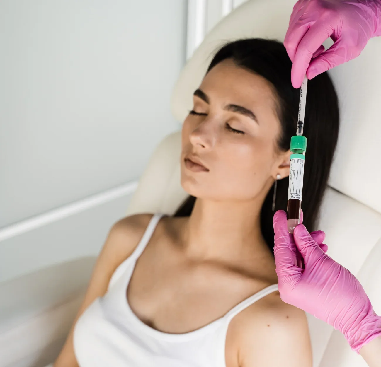 Cosmetologist with test tube with blood and plasma for PRP Platelet Rich Plasma procedure () Cosmetologist with test tube with blood and plasma for PRP Platelet Rich Plasma procedure ()