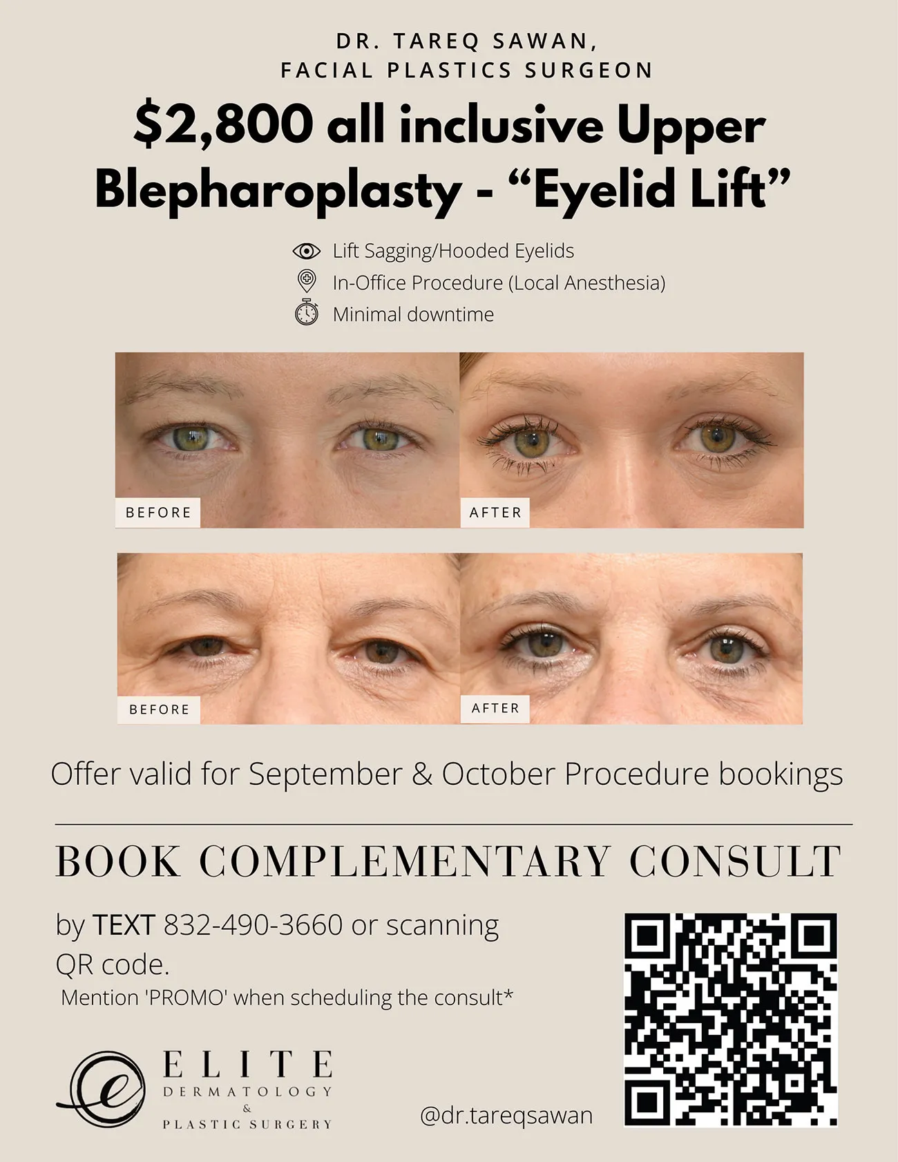 Eyelid Lift September Promo