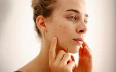 Skin Cancer on the Face: Why Mohs Surgery Is Often the Best Option